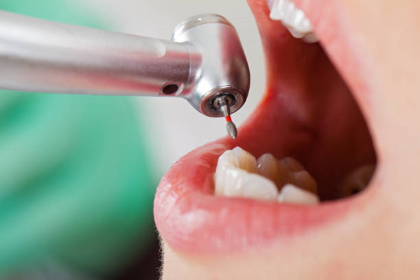 Tooth Infection Emergency Dentist in KY